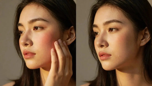 How to Calm Sun Damaged Skin - Prejuv