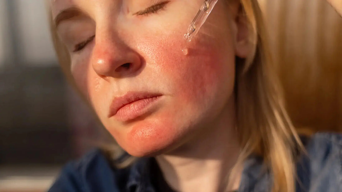 Person feeling retinol irritation on sensitive skin — redness and burning after retinol application