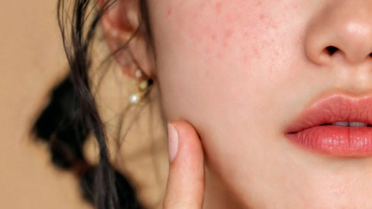 Woman with sensitive skin checking redness after cleansing — building the right sensitive skin routine starts with barrier repair